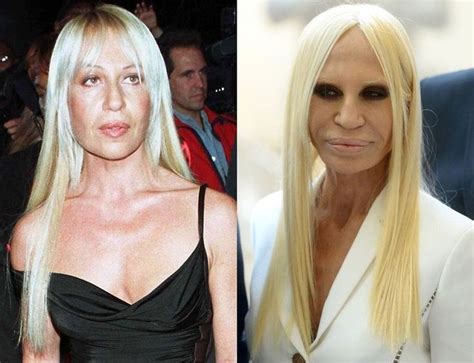 day before donatella versace|donatella versace without plastic surgery.